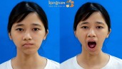 KHÁT KHAO ĐƯỢC “LẤP ĐẦY” CỦA CÔ GÁI MẶT LÕM