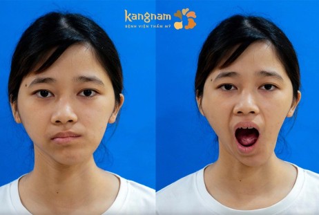 KHÁT KHAO ĐƯỢC “LẤP ĐẦY” CỦA CÔ GÁI MẶT LÕM