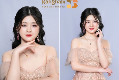 Cộng đồng mạng “vỡ oà” với màn lột xác ngoạn mục của cô gái mặt lõm