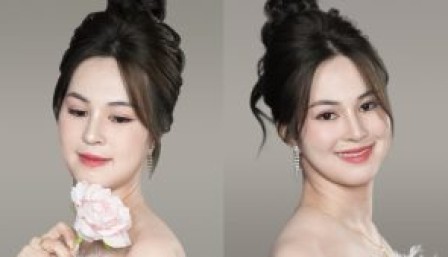 Cô giáo hàm hô, cười hở lợi ‘lột xác’ sau ba lần phẫu thuật